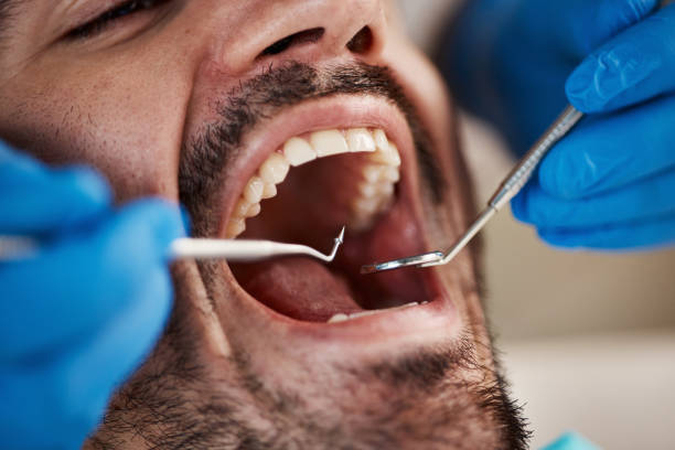Best Cosmetic Emergency Dentistry in Beechwood, MS